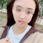 術后照片