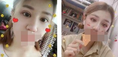 做了全切雙眼皮不僅外表變美了，內(nèi)心也更加自信了
