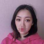 做完雙眼皮手術眼睛更加迷人了，眼睛自己會撩小哥哥