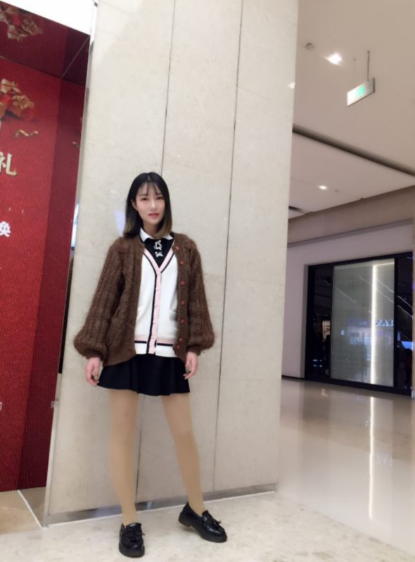 成都美立方整形醫(yī)院黃華醫(yī)生做大腿吸脂怎么樣？附大腿吸脂案例