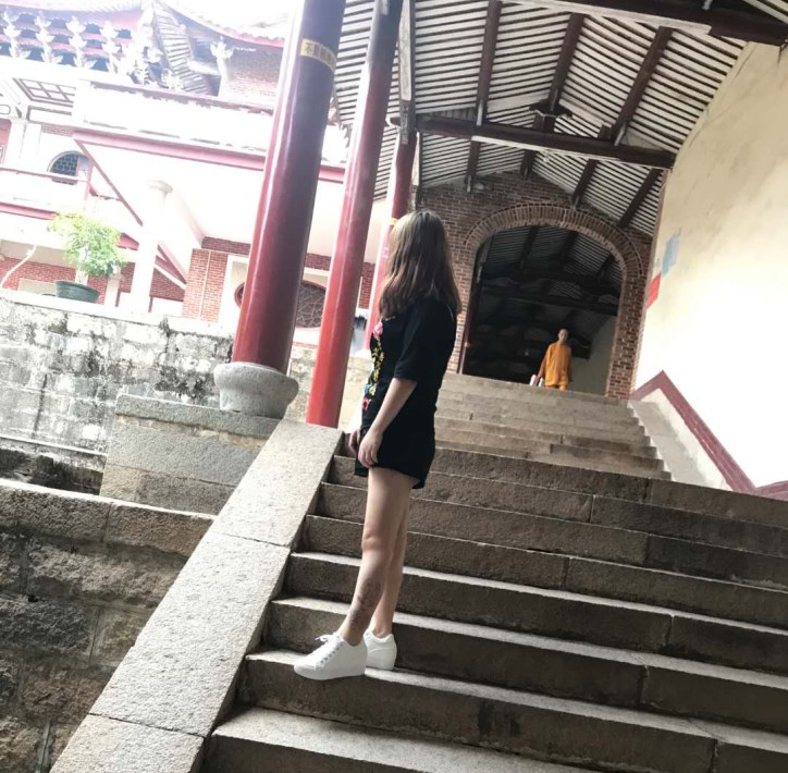 廣州軍頤醫(yī)院整形美容中心石建薇醫(yī)生腰腹吸脂真實(shí)案例對(duì)比圖