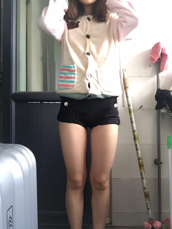 成都美立方整形醫(yī)院黃華醫(yī)生做大腿吸脂怎么樣？附大腿吸脂案例