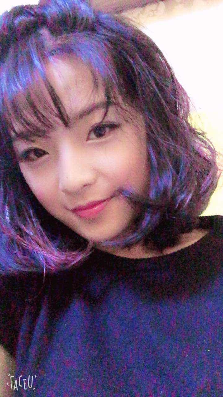 鄭州名門整形醫(yī)院董斌醫(yī)生做下頜角整形怎么樣？附下頜角整形案例