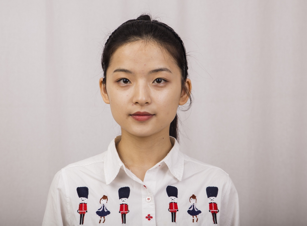 鄭州名門整形醫(yī)院董斌醫(yī)生做下頜角整形怎么樣？附下頜角整形案例