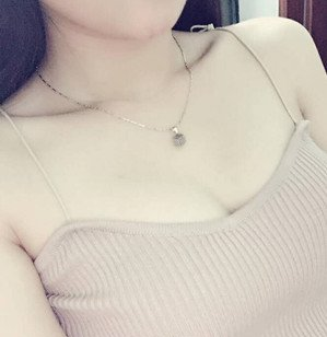 珠海萊茵醫(yī)療美容醫(yī)院崔俊溶醫(yī)生做自體脂肪隆胸效果怎么樣？附自體脂肪隆胸案例