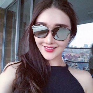 廣州柏德口腔蘭海龍醫(yī)生做瓷貼面效果怎么樣？廣州柏德口腔瓷貼面案例分享