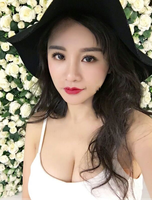 海南韓美醫(yī)學(xué)美容醫(yī)院李強醫(yī)生做自體脂肪隆胸效果怎么樣？附案例
