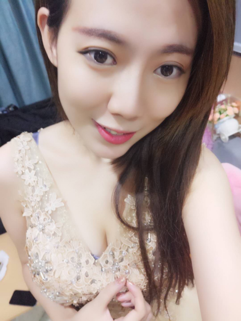 煙臺壹美整形醫(yī)院朱建瑩醫(yī)生做自體脂肪隆胸怎么樣？附自體脂肪隆胸案例