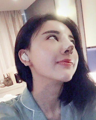 襄陽維多利亞整形醫(yī)院安邰晥醫(yī)生做鼻綜合整形怎么樣？附鼻綜合整形案例