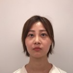 天津歐華威莎整形醫(yī)生姚玲做面部埋線提升效果怎么樣？附埋線提升案例