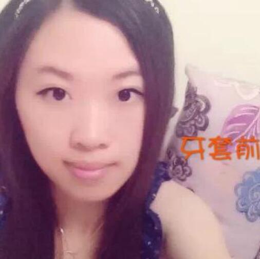 重慶嘉悅口腔醫(yī)院周繼祥醫(yī)生做金屬托槽矯正效果怎么樣？附案例效果對(duì)比圖