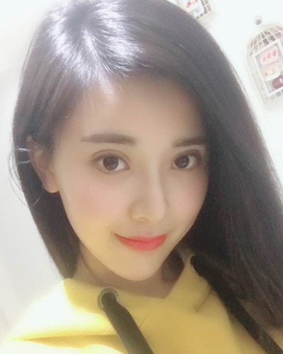 襄陽維多利亞整形醫(yī)院安邰晥醫(yī)生做鼻綜合整形怎么樣？附鼻綜合整形案例
