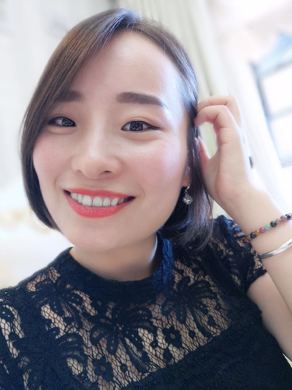 鄭州壹加壹整形醫(yī)院楊永利醫(yī)生做牙齒隱形矯正怎么樣？附牙齒隱形矯正案例