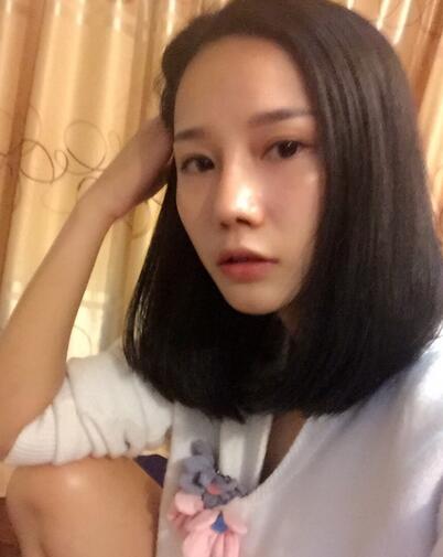 西安陽(yáng)光整形醫(yī)院邵萍醫(yī)生做鼻綜合整形怎么樣？附鼻綜合整形案例