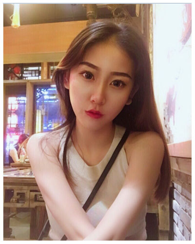 珠海海大整形美容外科黃發(fā)醫(yī)生做面部吸脂怎么樣？附面部吸脂案例
