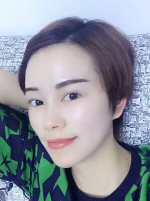 西安壹加壹整形醫(yī)院劉晨醫(yī)生做點(diǎn)陣激光祛痘效果怎么樣？附點(diǎn)陣激光祛痘效果圖