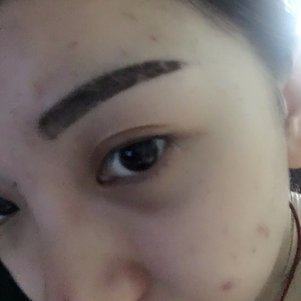 大同清木整形醫(yī)院張樹霞醫(yī)生做半永久紋眉效果如何？附半永久紋眉效果圖