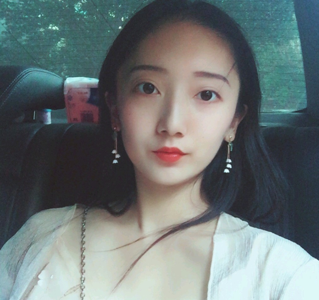 深圳鵬愛醫(yī)療美容醫(yī)院醫(yī)生文炯軫做埋線隆鼻怎么樣？附案例