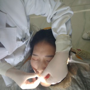 黔西南興義京州口腔醫(yī)院醫(yī)生徐勇做牙貼面怎么樣？附案例效果對(duì)比圖