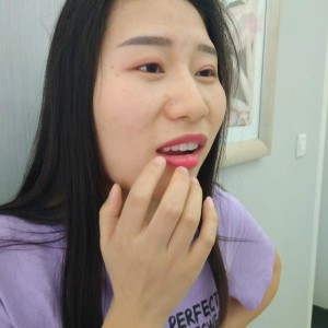 黔西南興義京州口腔醫(yī)院醫(yī)生徐勇做牙貼面怎么樣？附案例效果對(duì)比圖