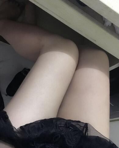 上海保加醫(yī)療美容門診部做大腿吸脂怎么樣？附楊勇醫(yī)生案例效果對比圖