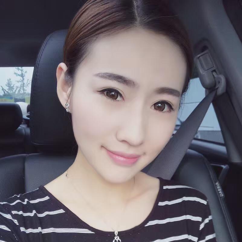 貴陽(yáng)美和諧醫(yī)療整形醫(yī)生孫澤芳做切開雙眼皮效果怎么樣？附案例效果對(duì)比圖