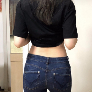 北京可思美整形醫(yī)院醫(yī)生斯勤做腰腹吸脂怎么樣？附案例效果對(duì)比圖