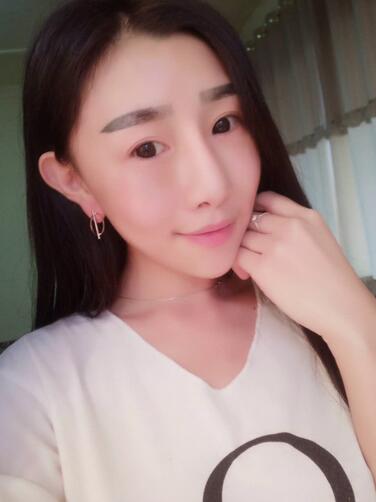 貴陽(yáng)泰康樂(lè)醫(yī)院整形美容科醫(yī)生陳璐做自體脂肪全臉填充效果怎么樣？