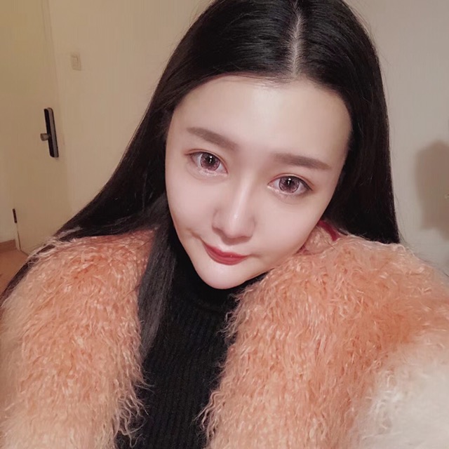 杭州格萊美整形美容醫(yī)院醫(yī)生張霞飛做自體脂肪全臉填充效果怎么樣？