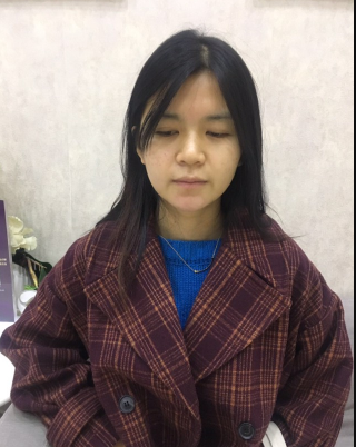 上海時(shí)光整形外科醫(yī)院醫(yī)生何晉龍做假體隆胸怎么樣？附案例效果對比圖