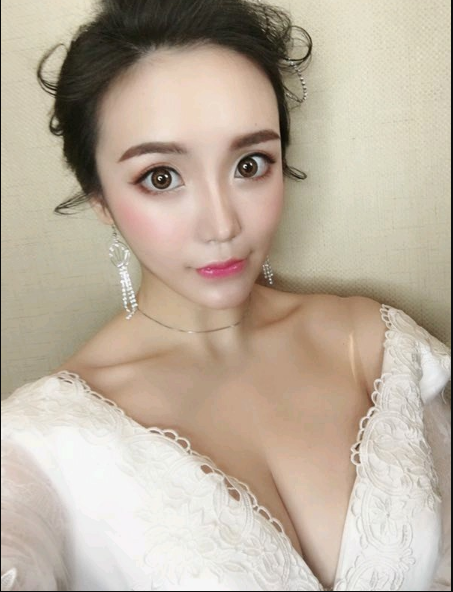 重慶當代整形美容醫(yī)院醫(yī)生楊健做假體隆胸怎么樣？附案例