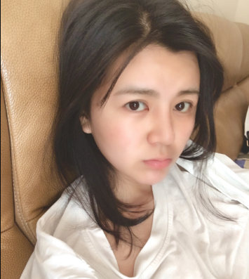 上海時光整形外科醫(yī)院醫(yī)生何晉龍做假體隆胸怎么樣？附案例效果對比圖