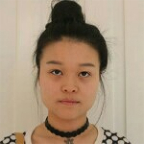 鄭州管城中醫(yī)院整形美容中心醫(yī)生張秀英做注射瘦臉怎么樣？附除皺瘦臉案例效果圖
