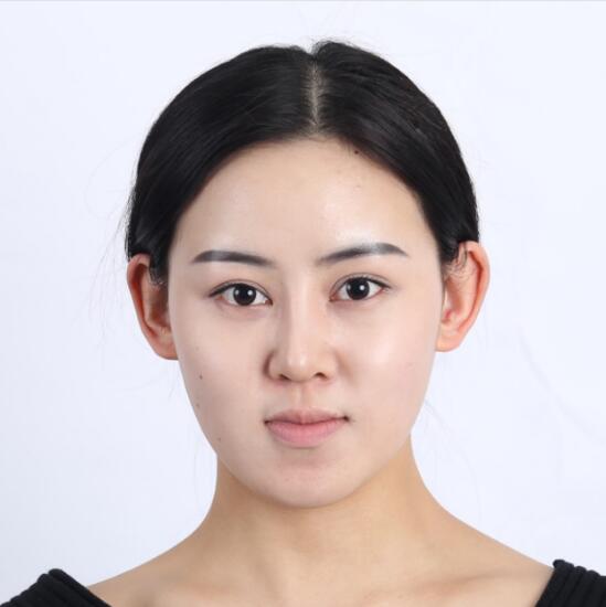 上海時(shí)光整形外科醫(yī)院醫(yī)生李靜林做假體隆鼻和反頜手術(shù)怎么樣？