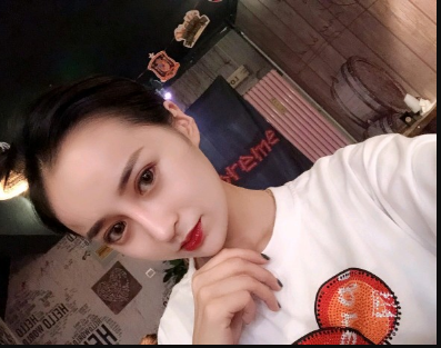 武漢米蘭醫(yī)療美容醫(yī)生柳再億做眼綜合+鼻綜合整形怎么樣？附真實(shí)案例對(duì)比圖