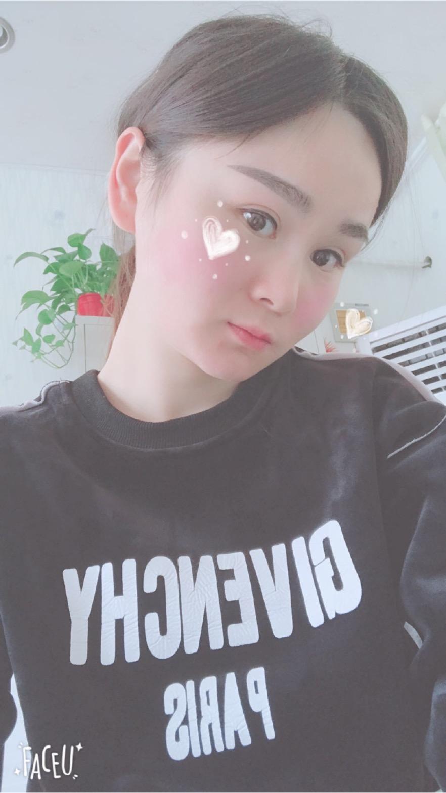 北京彤美美容整形醫(yī)院醫(yī)生楊曉惠做顴骨內(nèi)推+面部吸脂手術(shù)效果怎么樣？附案例