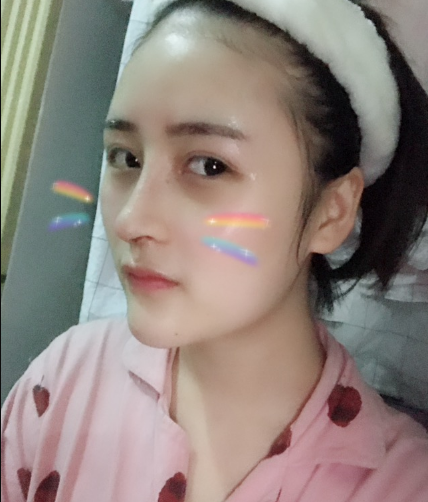 北京伊美爾美容愛(ài)康醫(yī)院醫(yī)生柳成做鼻綜合整形怎么樣？附案例效果圖