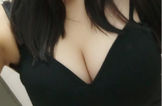 武漢伽美醫(yī)療美容醫(yī)院醫(yī)生朱富初做自體脂肪隆胸怎么樣？看案例