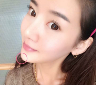 上海新健威醫(yī)療美容門(mén)診部下頜角填充