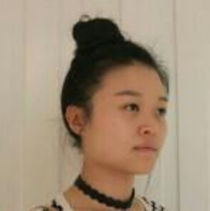 上海時(shí)光整形醫(yī)院左雯君醫(yī)生注射瘦臉針效果怎么樣？附真實(shí)案例圖