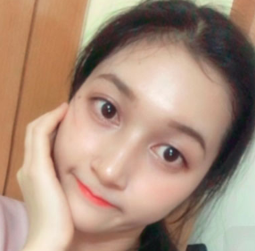 上海時光整形醫(yī)院做面部玻尿酸注射效果怎么樣？