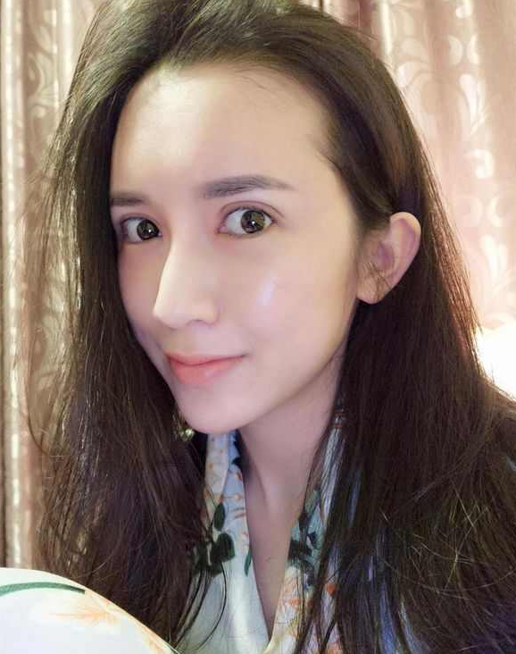 上海時(shí)光整形醫(yī)院張晶醫(yī)生做開眼角怎么樣？附真實(shí)效果圖