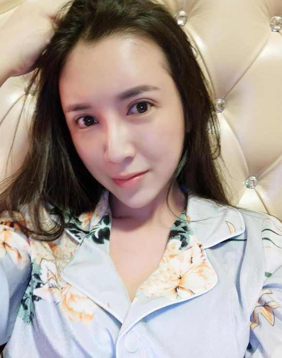 上海時(shí)光整形醫(yī)院張晶醫(yī)生做開眼角怎么樣？附真實(shí)效果圖