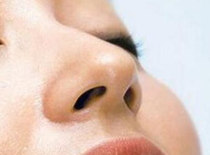 深圳鵬愛醫(yī)療美容醫(yī)院鼻小柱延長(zhǎng)