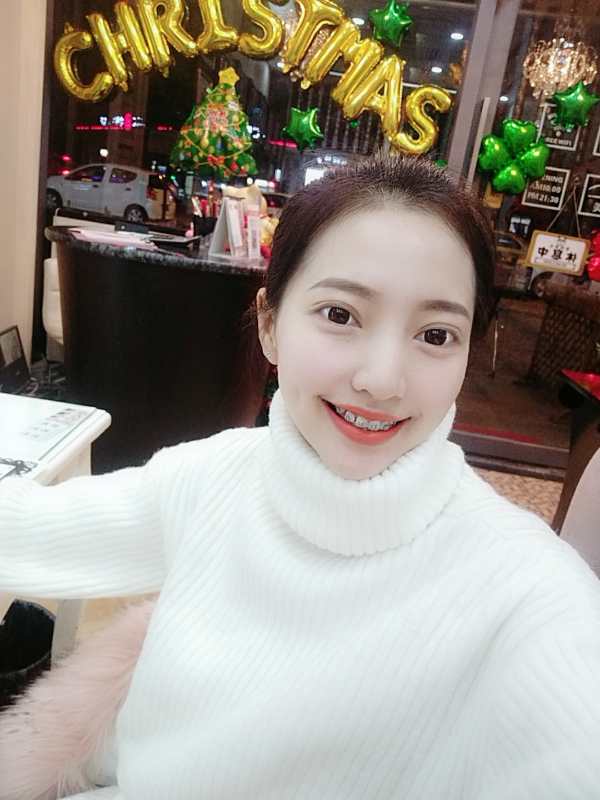巴中華醫(yī)口腔醫(yī)院做牙齒矯正效果好嗎？附母汶靈醫(yī)生牙齒矯正案例效果圖