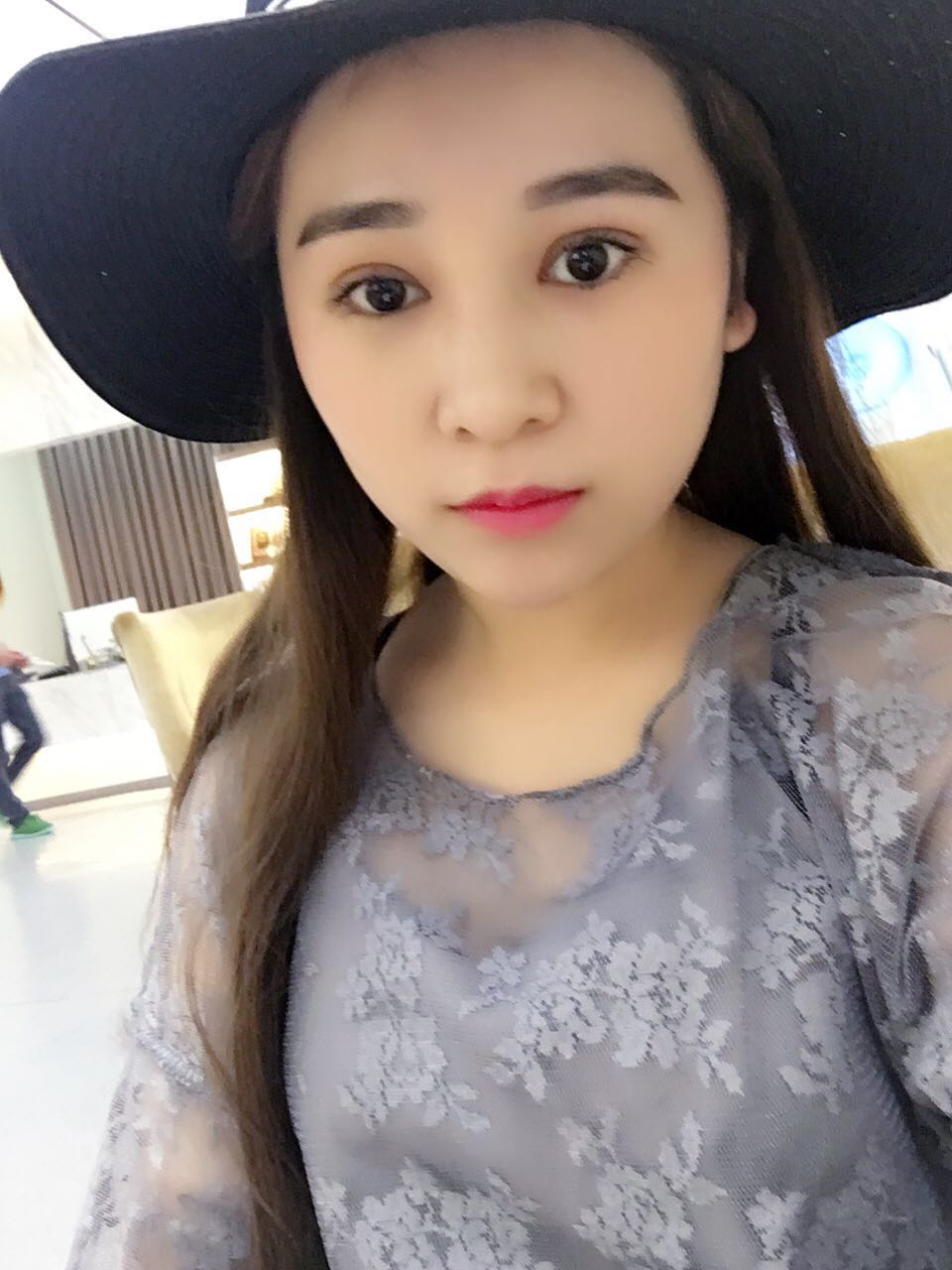 蚌埠韓美美萊整形醫(yī)生鄭捷做開眼角怎么樣？附案例效果圖