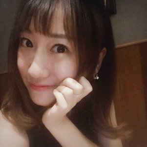 蚌埠韓美美萊整形做玻尿酸面部除皺效果怎么樣？附陳澤醫(yī)生案例效果圖