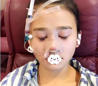 蚌埠韓美美萊整形醫(yī)生歷芳做耳軟骨隆鼻怎么樣？附耳軟骨隆鼻案例對(duì)比圖