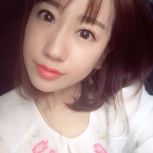 蚌埠韓美美萊整形做玻尿酸面部除皺效果怎么樣？附陳澤醫(yī)生案例效果圖