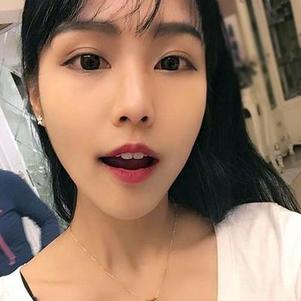 鞍山時(shí)代口腔門診部洗牙效果怎么樣？附申元休醫(yī)生洗牙案例效果圖